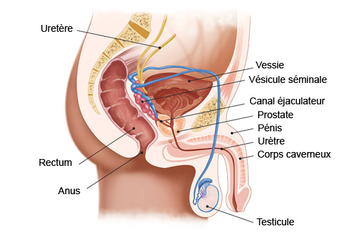 problème de prostate à 60 ans