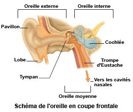 Otite et douleur d'oreille de l'adulte - symptômes, causes ...